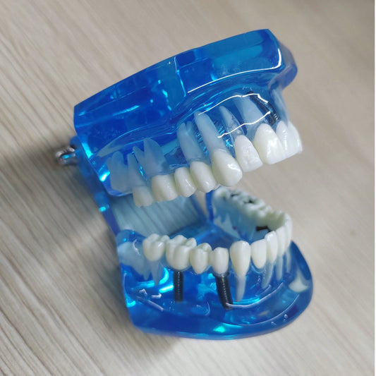 WWKTS Removable Dental Model Adult Tooth Demonstration Anatomical Medical Practice Model