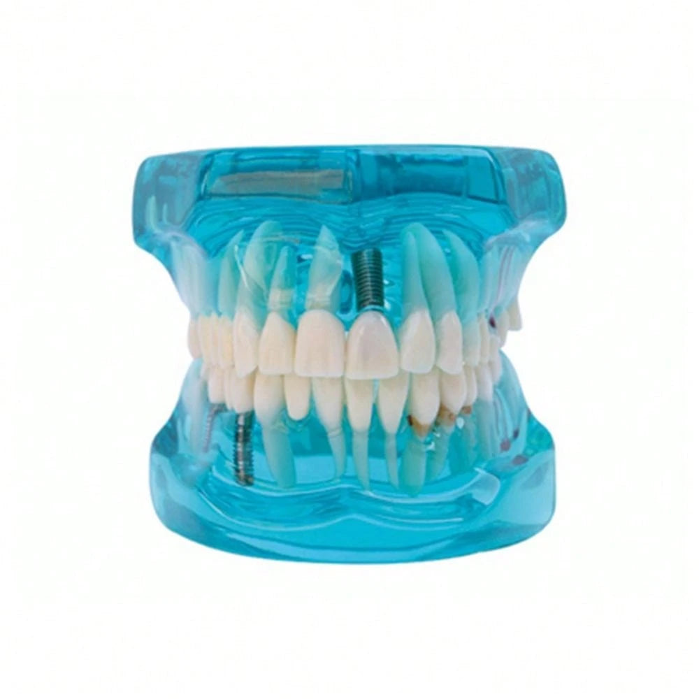 WWKTS Removable Dental Model Adult Tooth Demonstration Anatomical Medical Practice Model