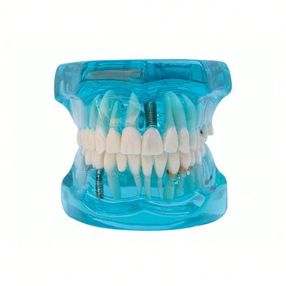 WWKTS Removable Dental Model Adult Tooth Demonstration Anatomical Medical Practice Model