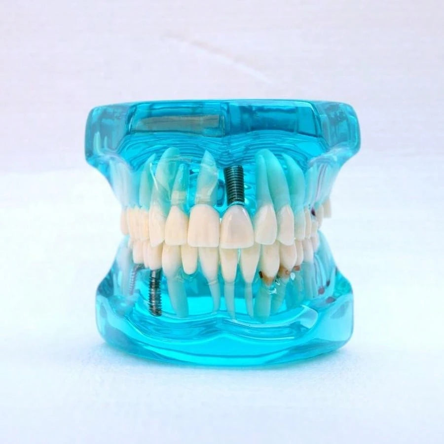 WWKTS Removable Dental Model Adult Tooth Demonstration Anatomical Medical Practice Model
